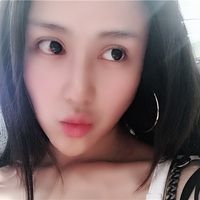 杜太超隆鼻失败修复技术真的好吗?我仿佛看见了希望