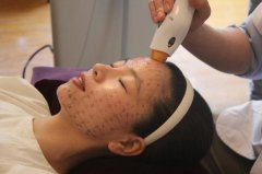 热玛吉第三代有哪些优势? width=