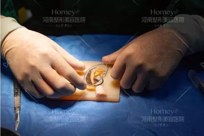 张正文答患者问：“再造的耳朵”和真耳朵一样吗？