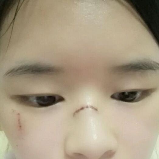 深圳广济医院正规吗?听说祛疤痕果还不错