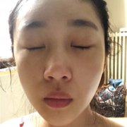 刘冬青院长整体实力如何?听说很擅长隆鼻? width=