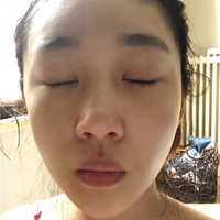 刘冬青院长整体实力如何?听说隆鼻很厉害?