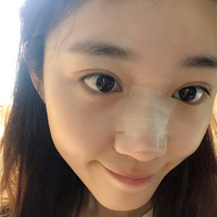 刘冬青院长整体实力如何?听说隆鼻很厉害?