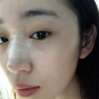刘冬青院长整体实力如何?听说隆鼻很厉害?