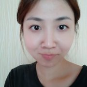 尖下颌角整形果如何?多久能恢复? width=