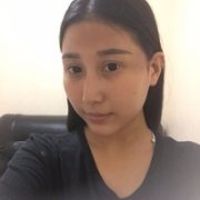伊美尔长岛医院国字脸整形技术如何?真人案例展示 width=