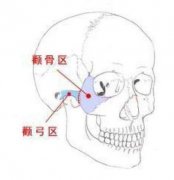 颧骨内推术后要注意什么? width=