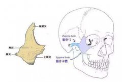 3d颧骨内推靠谱吗?没问题性高吗? width=