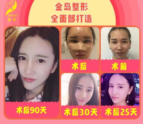 微整形市场潜规则之对整形的偏见，是变美路上******的绊脚石！