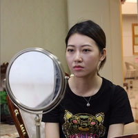 郑州梨花雨整形医院嫩肤技术怎么样?丑小鸭变白天鹅案例分享