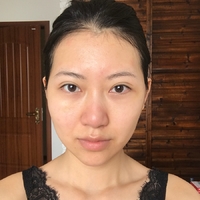 郑州梨花雨整形医院嫩肤技术怎么样?丑小鸭变白天鹅案例分享