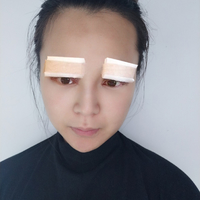 成都米亚整形口碑如何?我想到此做个双眼皮