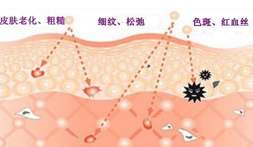 王-者之心激光美容有什么优点?能让我皮肤变好吗?