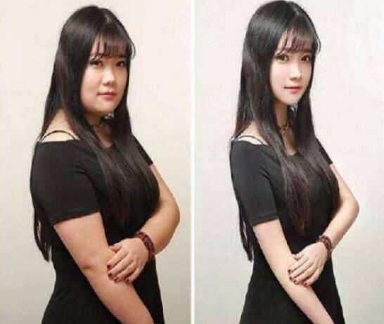 激光溶脂多少钱?有哪些影响因素?