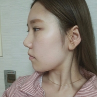 伊美尔健翔医院好不好?相关的技术水平如何?