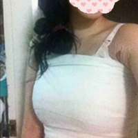 广州星团医学美容隆胸技术如何?我想摆脱平胸局面