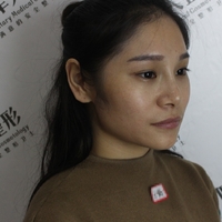 oe冷光子嫩肤仪果如何?价钱贵吗?