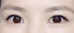 埋眼线能保持多久?不会是长久的吧 width=