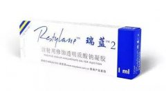 瑞兰注射除皱多少钱? width=