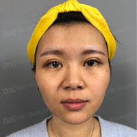 方跃明医生注射除皱技术如何?真能恢复年轻貌美吗?