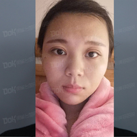 方跃明医生注射除皱技术如何?真能恢复年轻貌美吗?