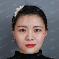 方跃明医生注射除皱技术如何?真能恢复年轻貌美吗?
