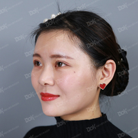 方跃明医生注射除皱技术如何?真能恢复年轻貌美吗?