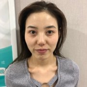 orbis美白丸怎么样?果好吗? width=