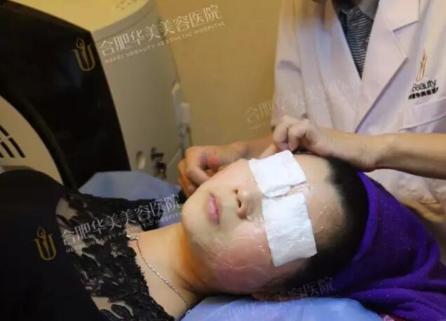 彩光换肤的果如何?真能去除我这难缠红血丝吗?