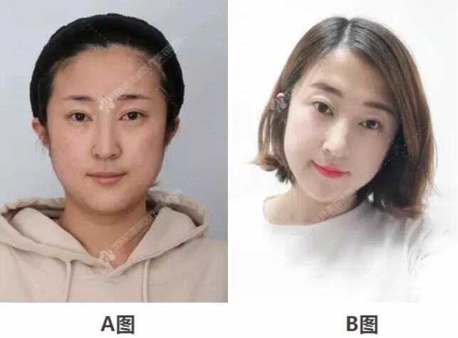 百嘉丽抢韩式隐形美瞳线， 1980元+补色一次，限量10份！