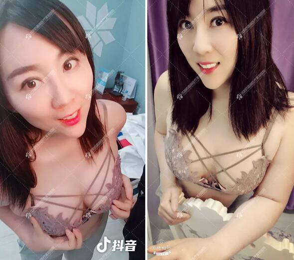 傲诺拉隆胸后，抖音刷屏成网红，她的一句忠告火了……