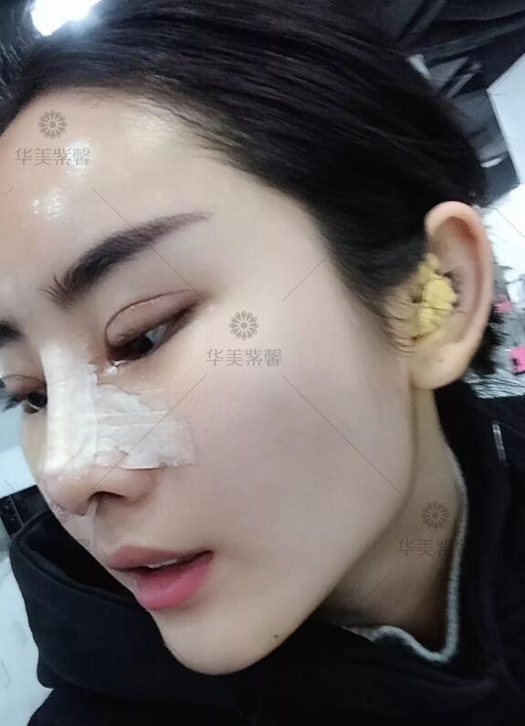 双眼皮宽度6mm好看吗？这个小姐姐用经历告诉你！