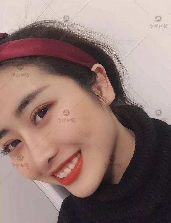 双眼皮宽度6mm好看吗？这个小姐姐用经历告诉你！