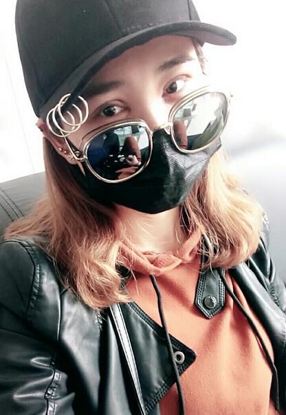 杭州格莱美整容医院汪云锋割双眼皮贵不贵？先来看看这案例~