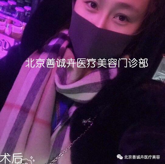善诚卉张维娜做克隆隆鼻