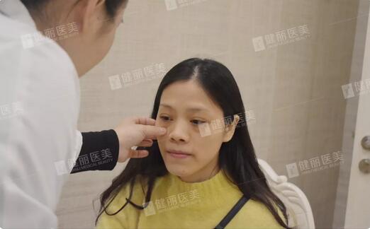 健丽光乳化去眼袋