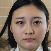 北京基础美整形鼻部手术技术怎么样?真的很擅长吗?