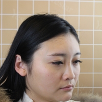 北京基础美整形鼻部手术技术怎么样?真的很擅长吗?