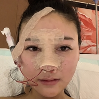 北京基础美整形鼻部手术技术怎么样?真的很擅长吗?
