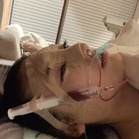 北京基础美整形鼻部手术技术怎么样?真的很擅长吗?