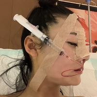 北京基础美整形鼻部手术技术怎么样?真的很擅长吗?