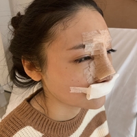 北京基础美整形鼻部手术技术怎么样?真的很擅长吗?