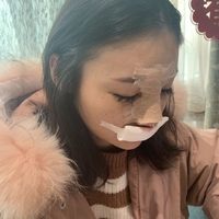北京基础美整形鼻部手术技术怎么样?真的很擅长吗?