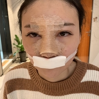 北京基础美整形鼻部手术技术怎么样?真的很擅长吗?
