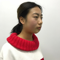 黄小闪双眼皮+垫下巴+美白案例分享~前后变化如此之大