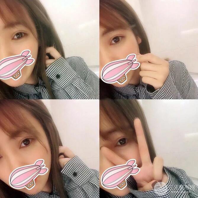 韩仕医美医院双眼皮技术如何?我想改变我这内双