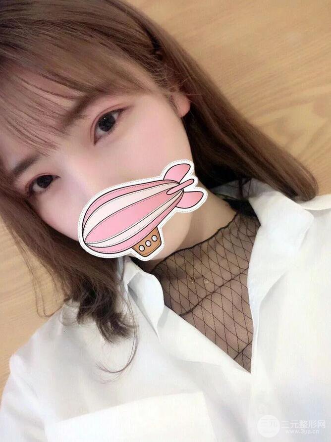 韩仕医美医院双眼皮技术如何?我想改变我这内双