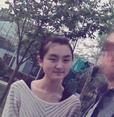 宁波尚丽整形美容医院脱唇毛果如何?我不想再“男人”下去