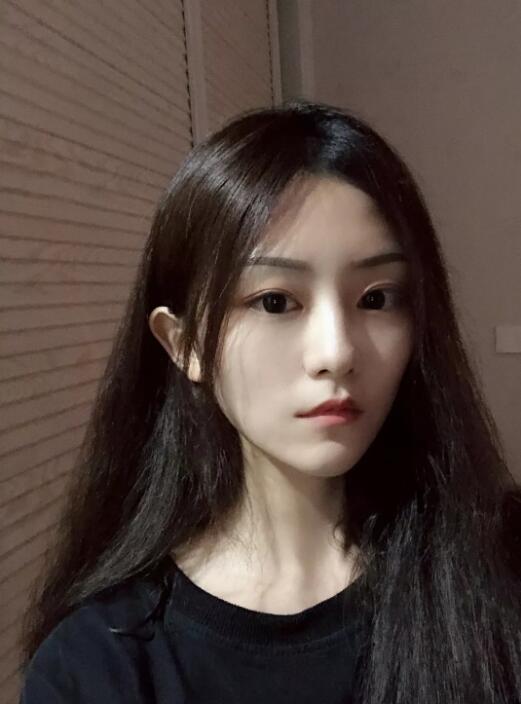 宁波尚丽整形美容医院脱唇毛果如何?我不想再“男人”下去