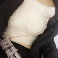 郑楚蓉较擅长那些项目?我想找她做隆胸能行吗?